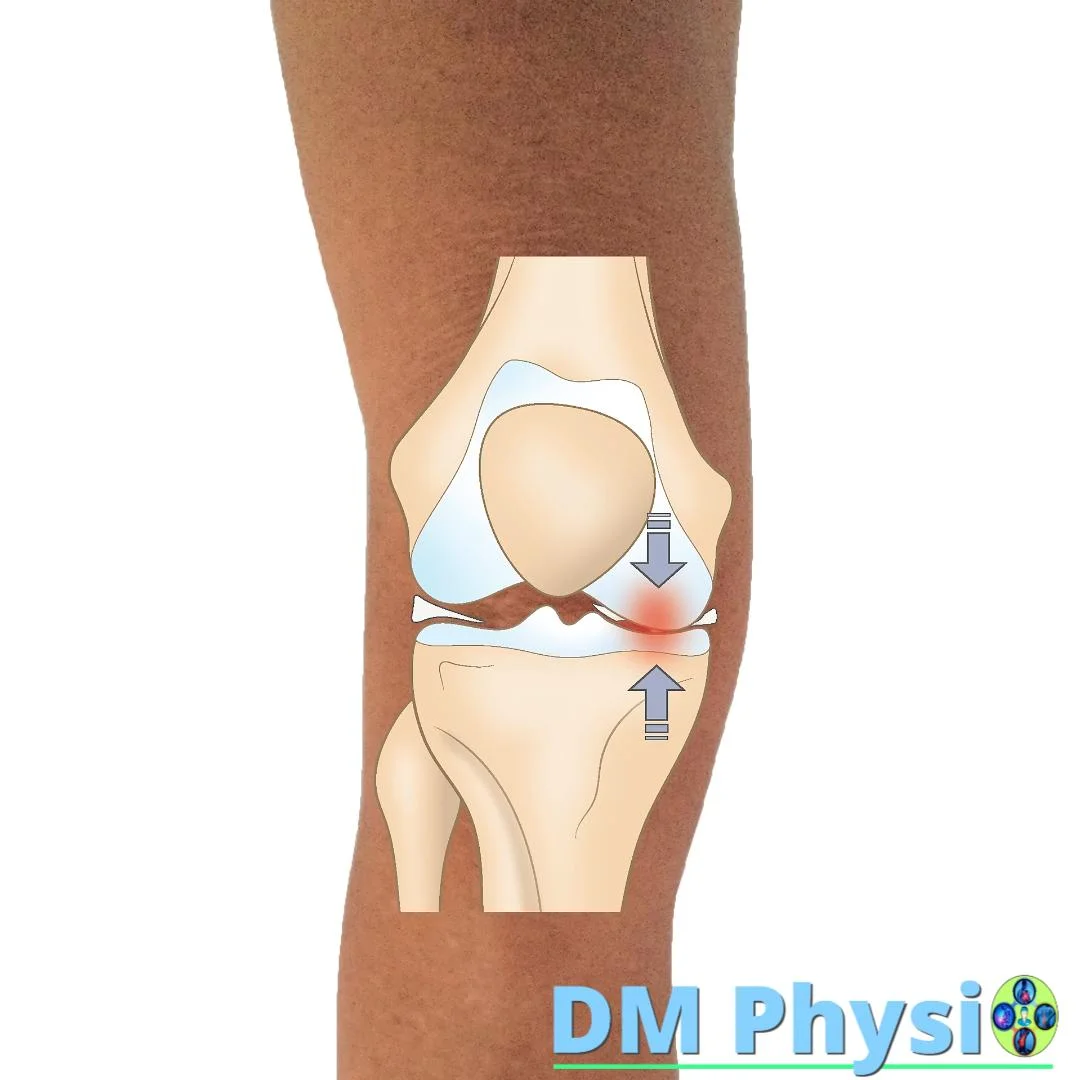 Анатомия на менискус